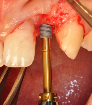 surgycal